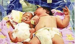 巨婴给吃瓜,揭秘吃瓜群众的狂欢与反思